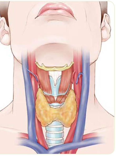 последствия удаления щитовидки