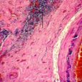 Щитовидная железа гистология