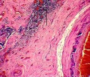 Щитовидная железа гистология