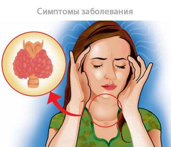 симптомы заболевания щитовидки
